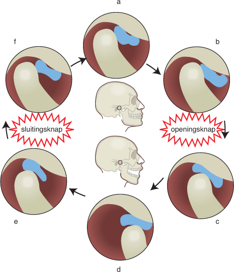 Kaakgewricht kinesitherapie